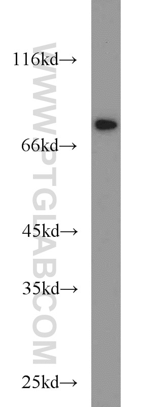 Western Blot (WB) analysis of Jurkat cells using TFEB Polyclonal antibody (13372-1-AP)