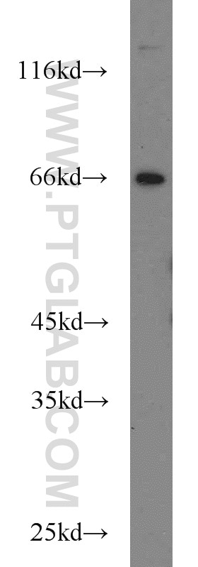 WB analysis of HeLa using 13372-1-AP