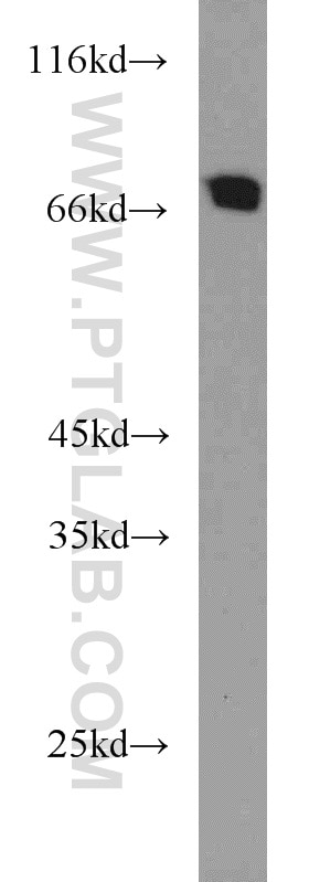 Western Blot (WB) analysis of human placenta tissue using TFEB Polyclonal antibody (13372-1-AP)