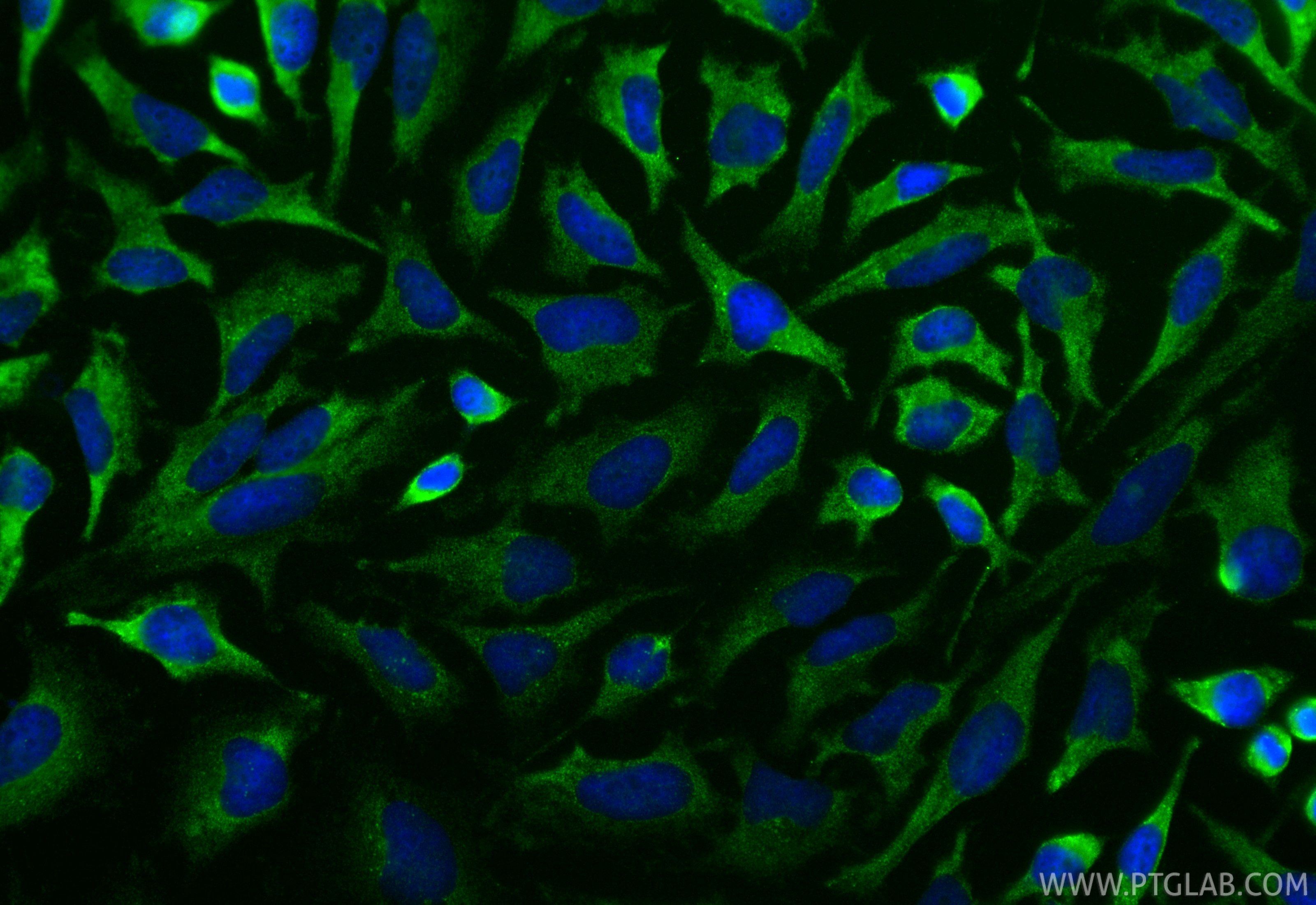 Immunofluorescence (IF) / fluorescent staining of HeLa cells using TFEB Recombinant antibody (84675-5-RR)