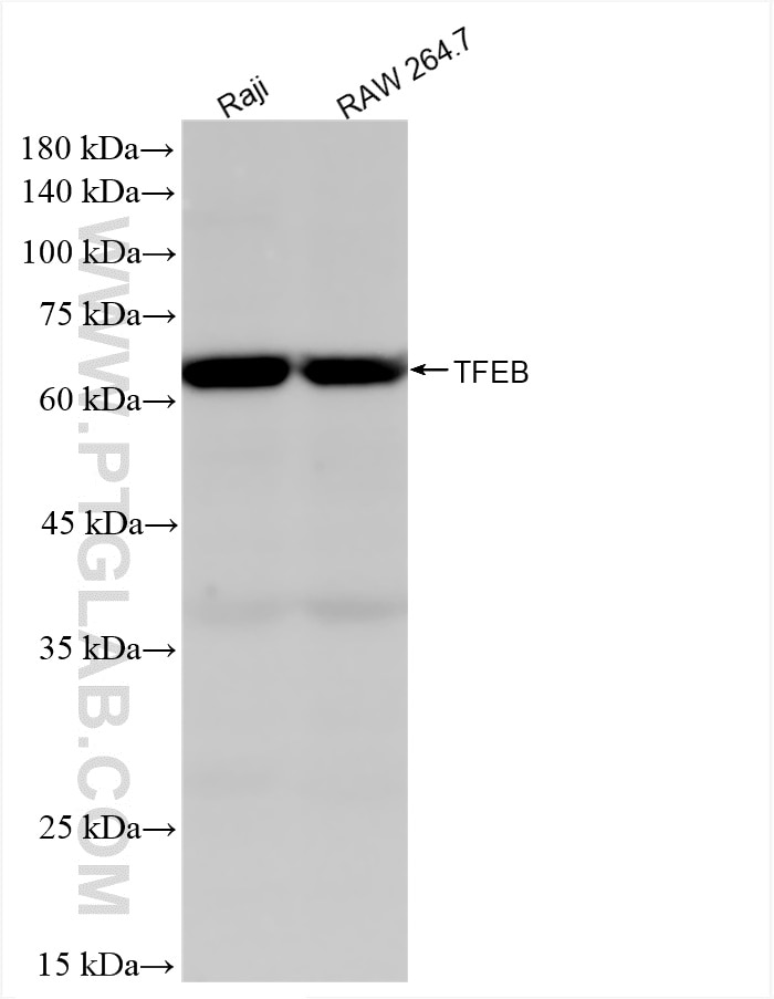 Western Blot (WB) analysis of various lysates using TFEB Recombinant antibody (84675-5-RR)