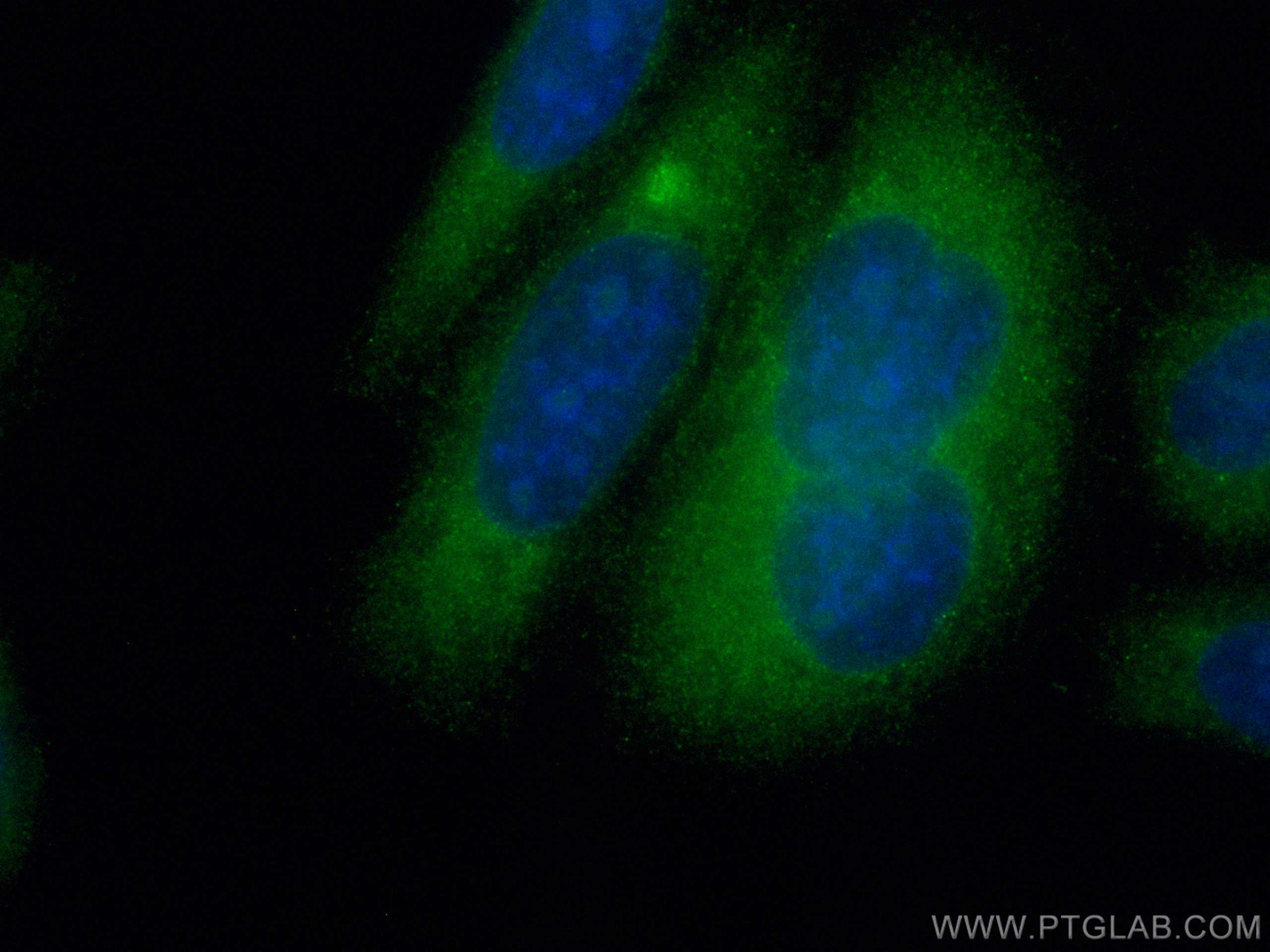 Immunofluorescence (IF) / fluorescent staining of HepG2 cells using CoraLite® Plus 488-conjugated TFEB Polyclonal anti (CL488-13372)
