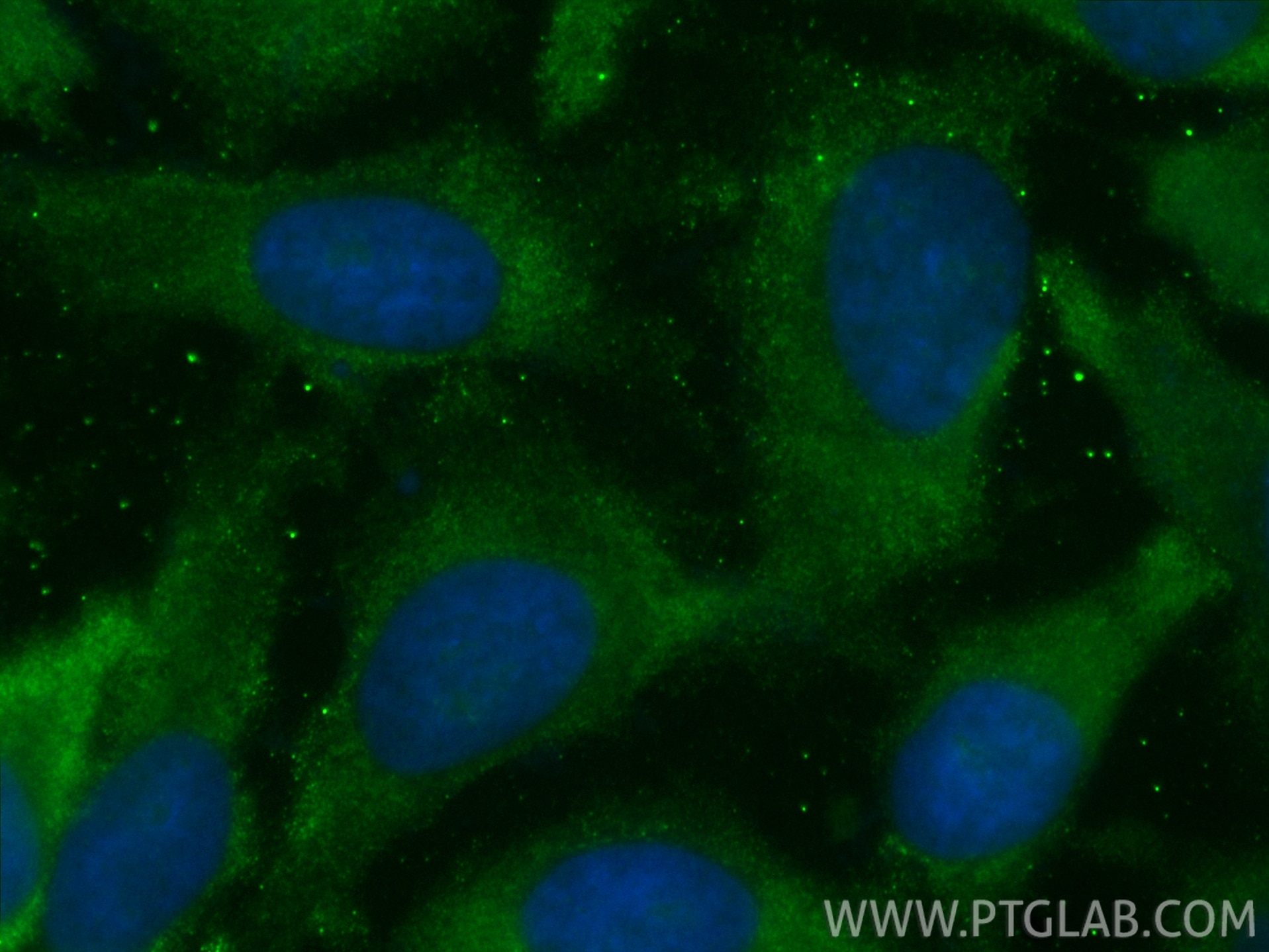 Immunofluorescence (IF) / fluorescent staining of HeLa cells using CoraLite® Plus 488-conjugated TFEB Recombinant mon (CL488-84675-5)