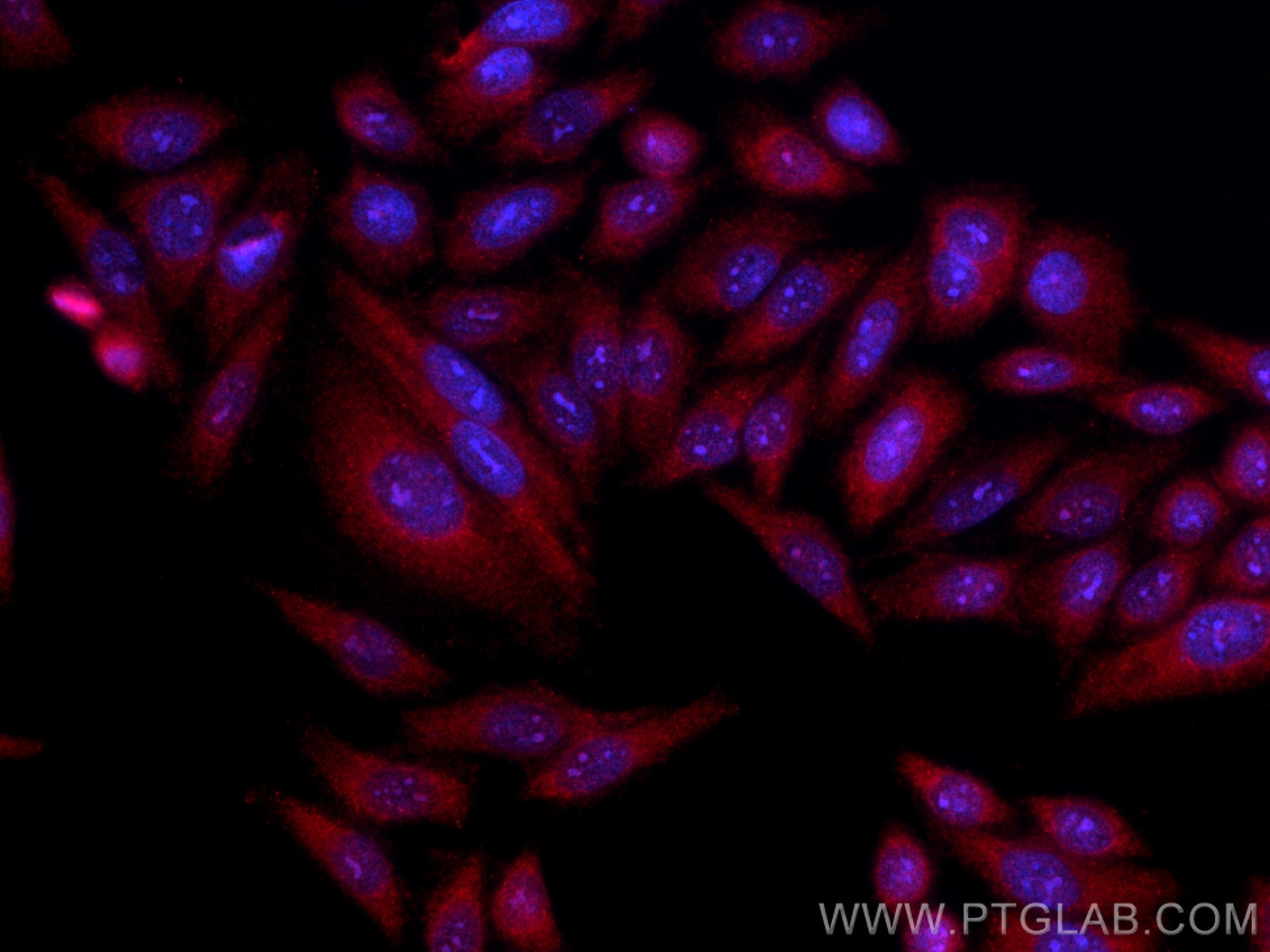IF Staining of HepG2 using CL594-13372