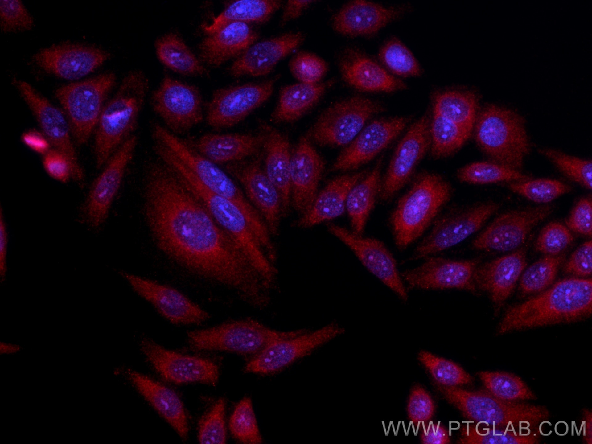 Immunofluorescence (IF) / fluorescent staining of HepG2 cells using CoraLite®594-conjugated TFEB Polyclonal antibody (CL594-13372)