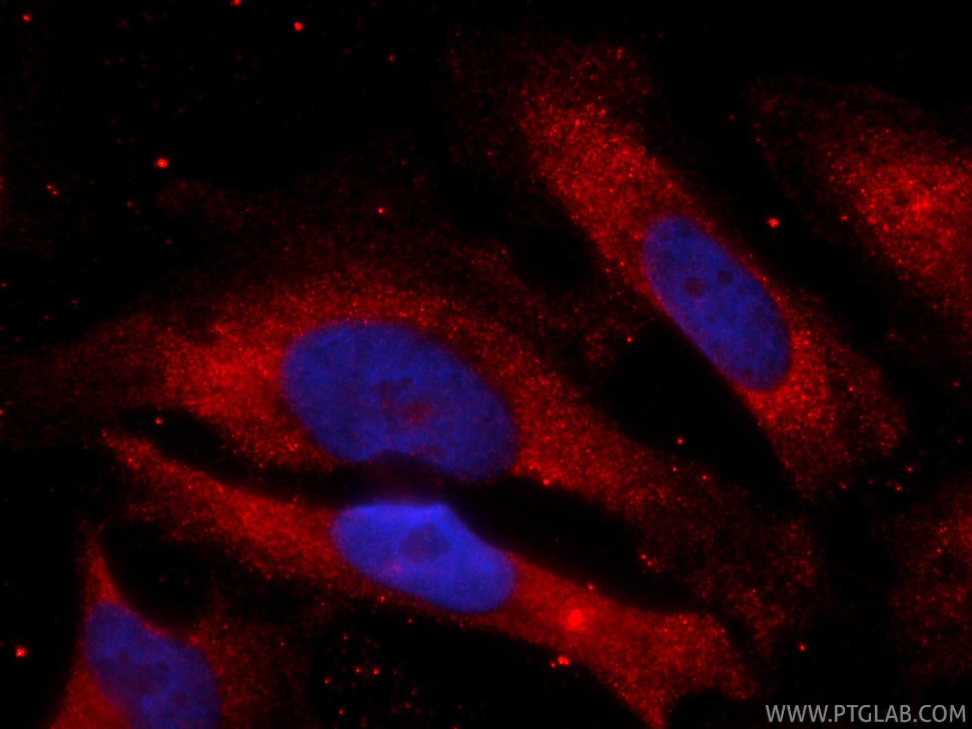 IF Staining of HeLa using CL594-84675-5 Immunofluorescence (IF) / fluorescent staining of HeLa cells using CoraLite®594-conjugated TFEB Recombinant monoclona (CL594-84675-5)