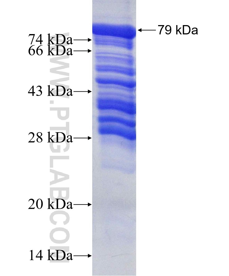 TFEB fusion protein Ag4194 SDS-PAGE