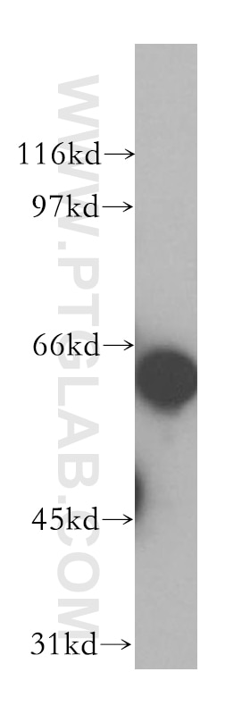 Western Blot (WB) analysis of COLO 320 cells using TFEC Polyclonal antibody (13547-1-AP)