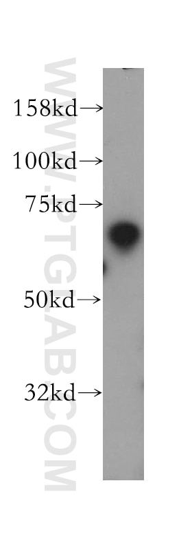 Western Blot (WB) analysis of mouse testis tissue using TFEC Polyclonal antibody (13547-1-AP)