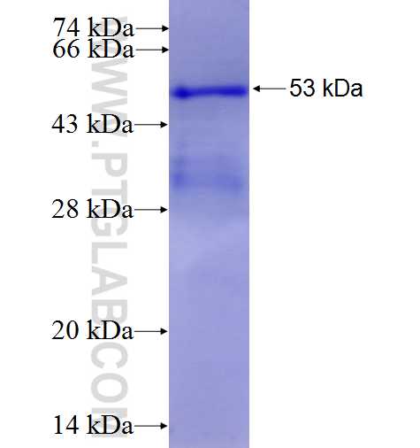 TFEC fusion protein Ag4061 SDS-PAGE