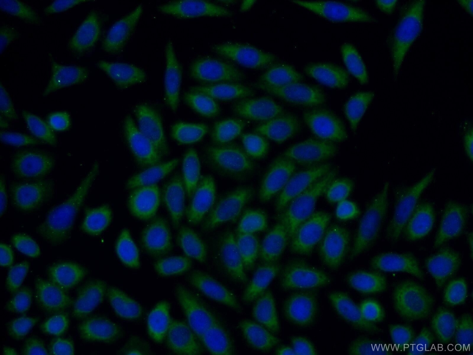 Trefoil factor 1 Polyclonal antibody