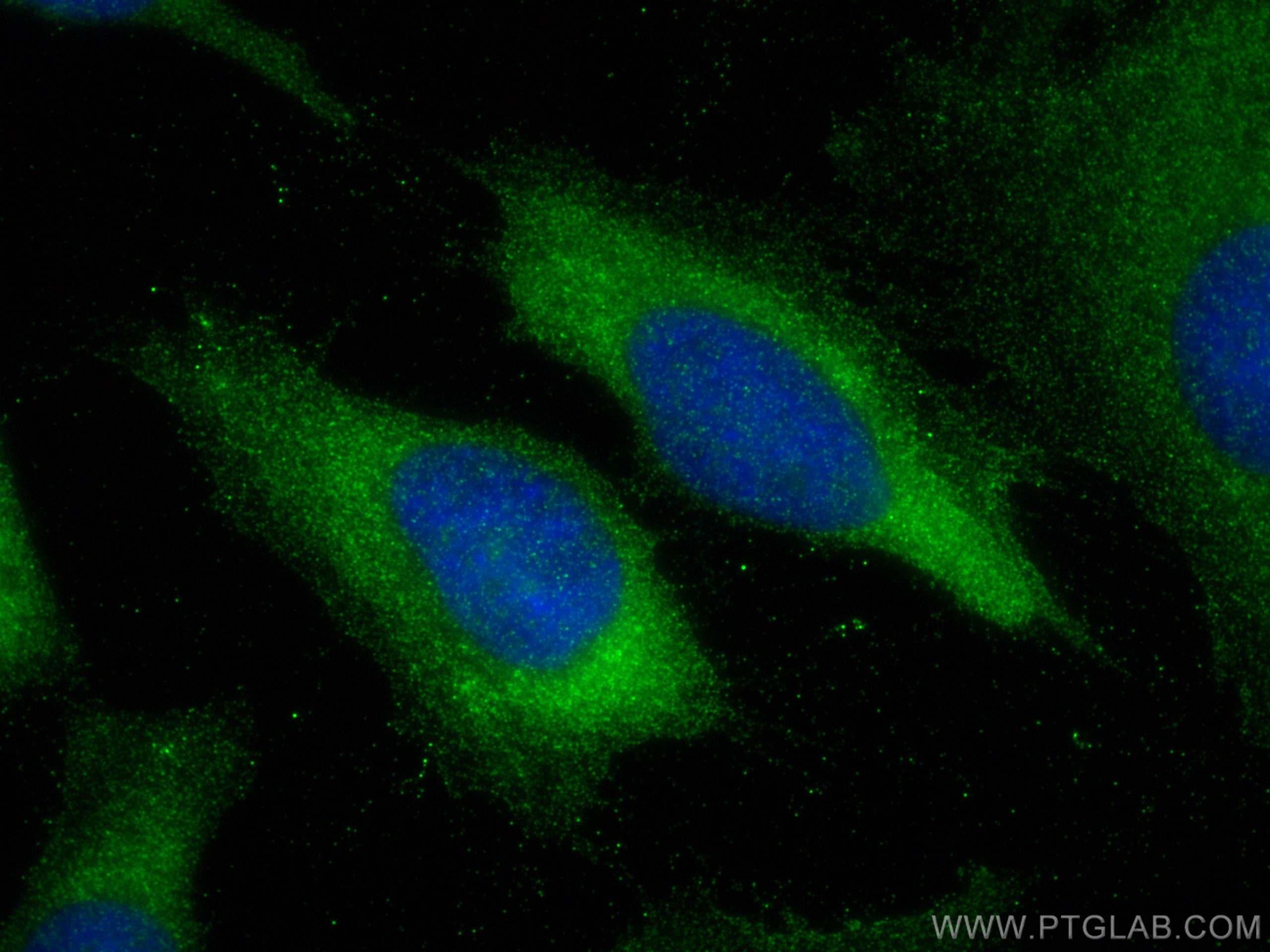 Immunofluorescence (IF) / fluorescent staining of HeLa cells using Trefoil factor 1 Polyclonal antibody (13734-1-AP)