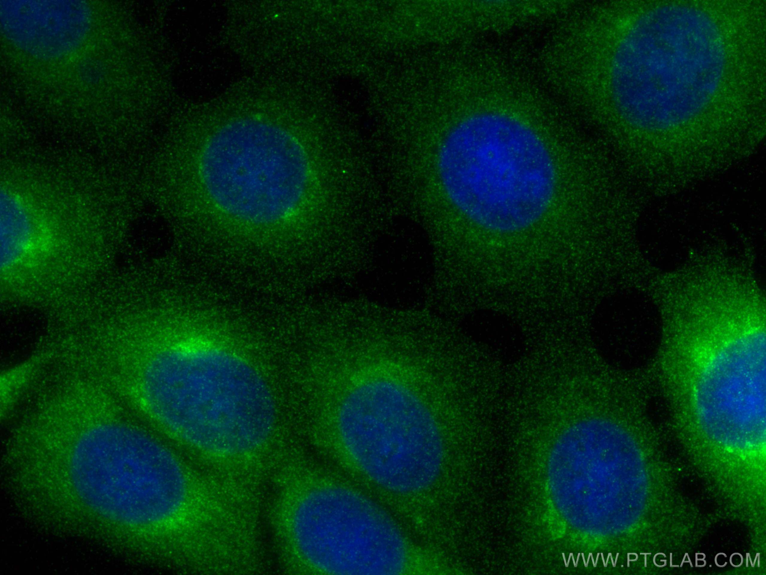 Immunofluorescence (IF) / fluorescent staining of MCF-7 cells using Trefoil factor 1 Polyclonal antibody (13734-1-AP)