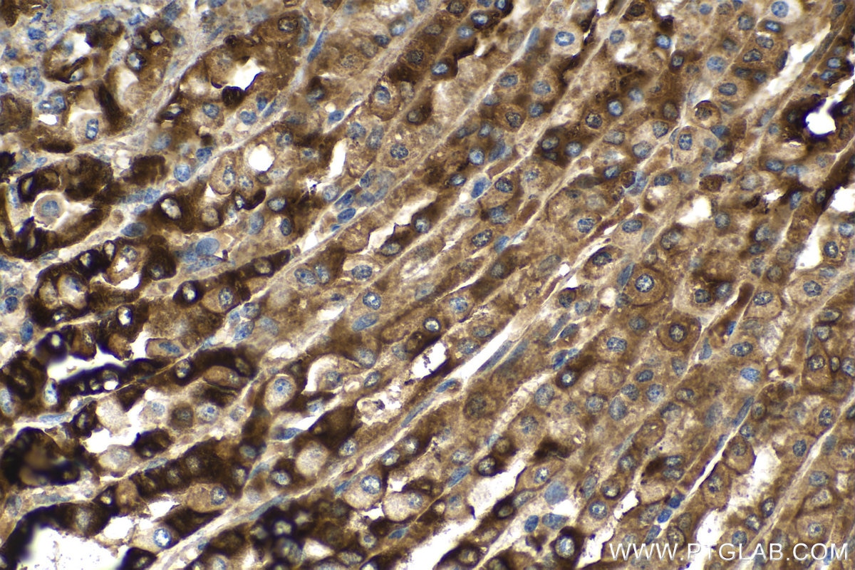 Immunohistochemistry (IHC) staining of rat stomach tissue using TFF1 Polyclonal antibody (13734-1-AP)