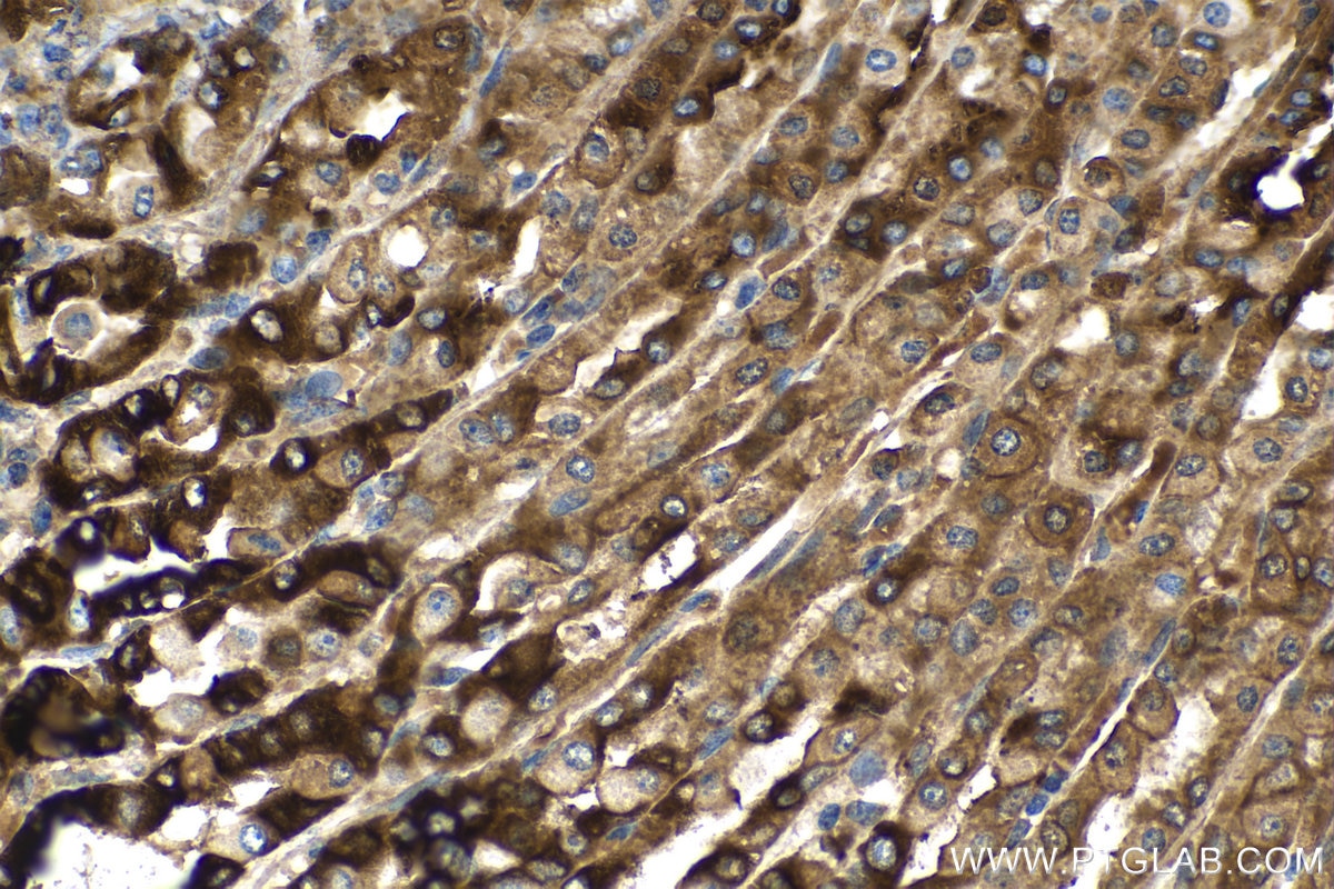 Immunohistochemistry (IHC) staining of rat stomach tissue using Trefoil factor 1 Polyclonal antibody (13734-1-AP)