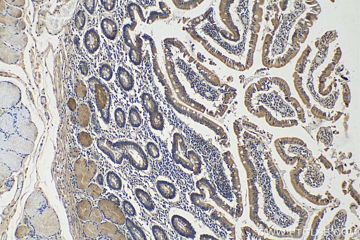 IHC staining of human stomach using 13734-1-AP