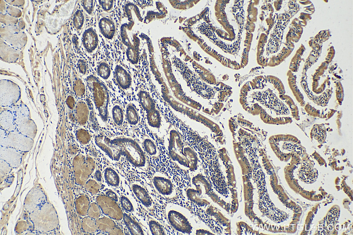 Immunohistochemistry (IHC) staining of human stomach tissue using TFF1 Polyclonal antibody (13734-1-AP)
