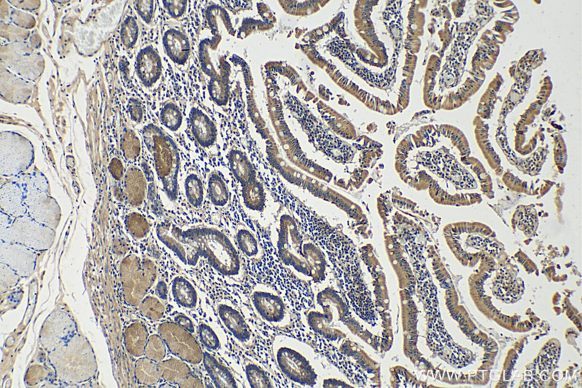 Immunohistochemistry (IHC) staining of human stomach tissue using Trefoil factor 1 Polyclonal antibody (13734-1-AP)