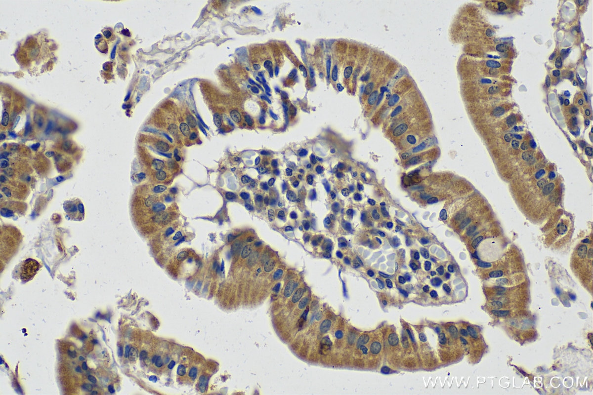 Immunohistochemistry (IHC) staining of human stomach tissue using TFF1 Polyclonal antibody (13734-1-AP)