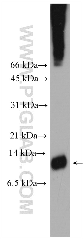 Western Blot (WB) analysis of mouse stomach tissue using TFF1 Polyclonal antibody (13734-1-AP)