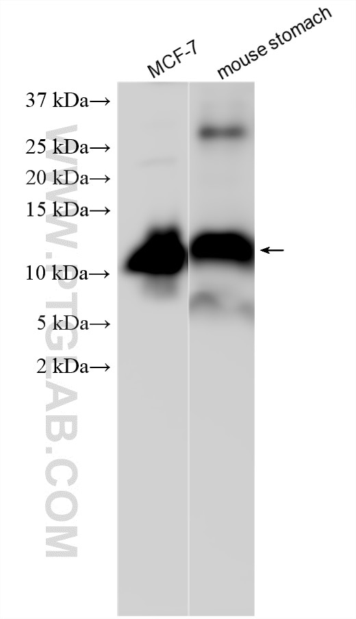 Western Blot (WB) analysis of various lysates using TFF1 Polyclonal antibody (13734-1-AP)