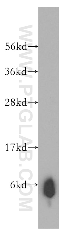 Western Blot (WB) analysis of human kidney tissue using Trefoil factor 1 Polyclonal antibody (13734-1-AP)