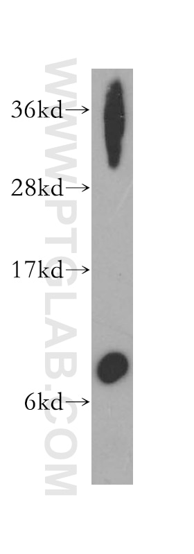 Western Blot (WB) analysis of human stomach tissue using Trefoil factor 1 Polyclonal antibody (13734-1-AP)