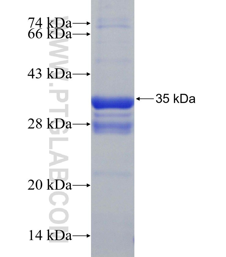 TFF1 fusion protein Ag4541 SDS-PAGE