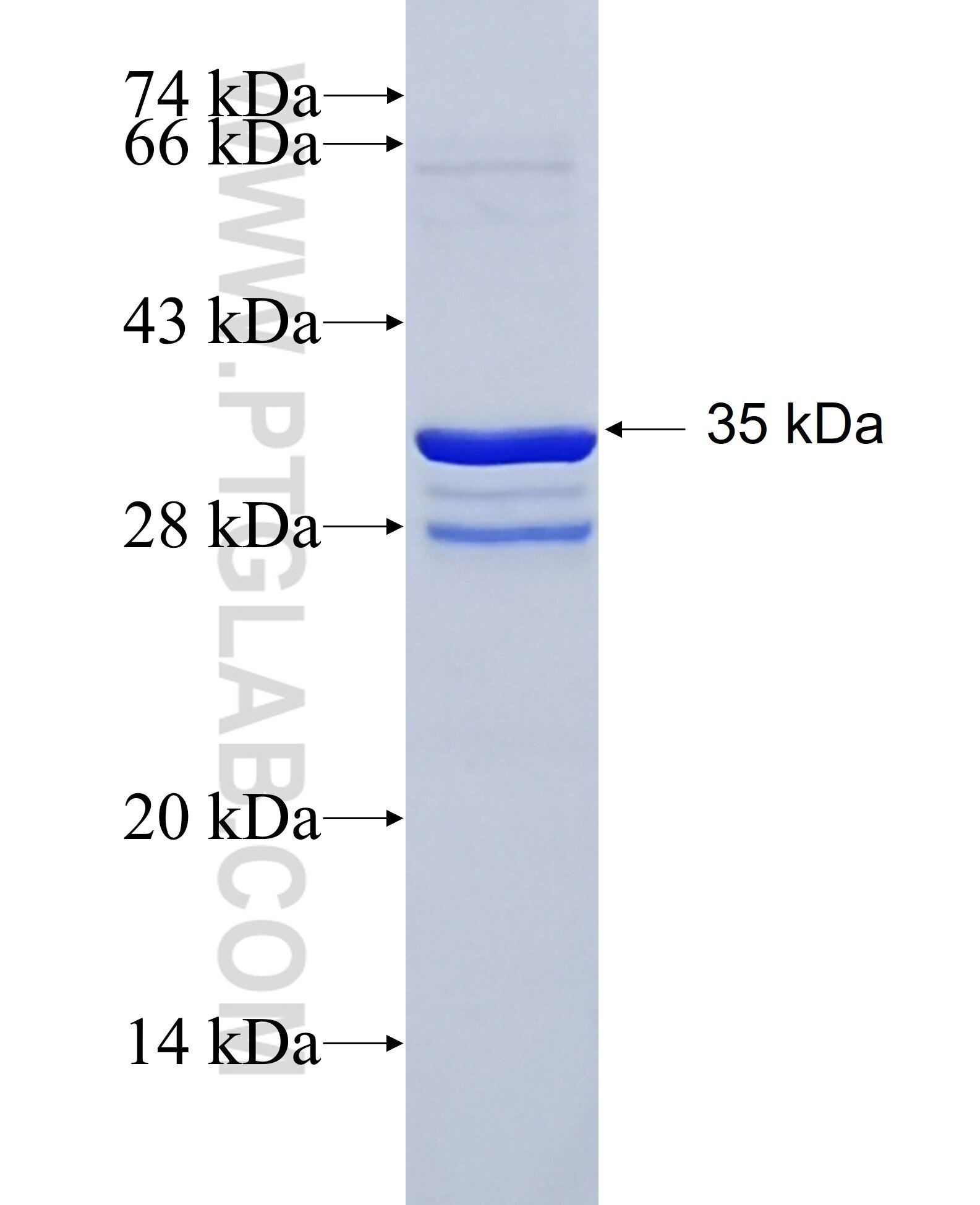 TFF1 fusion protein Ag4541 SDS-PAGE