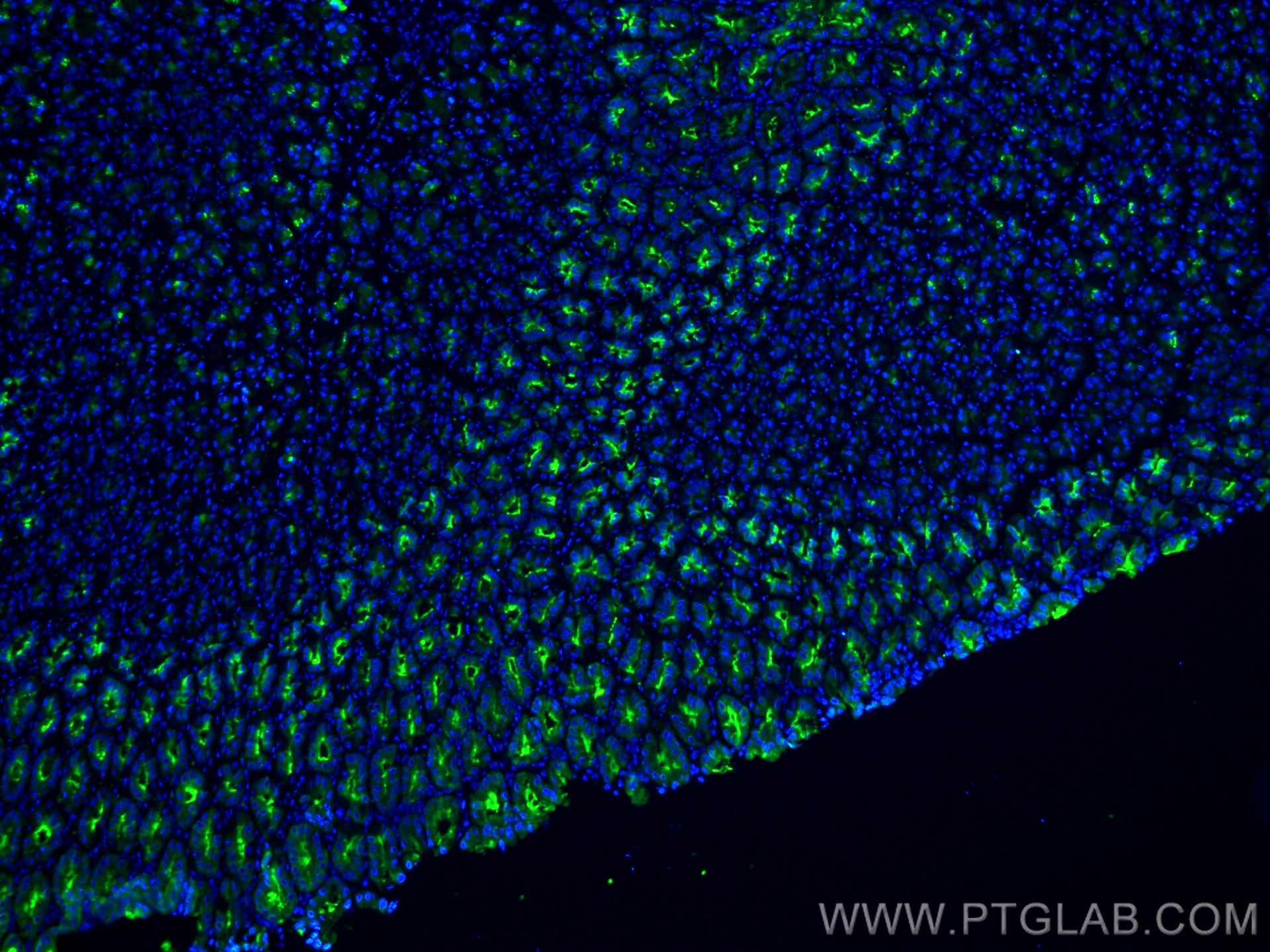 IF Staining of mouse stomach using 13681-1-AP