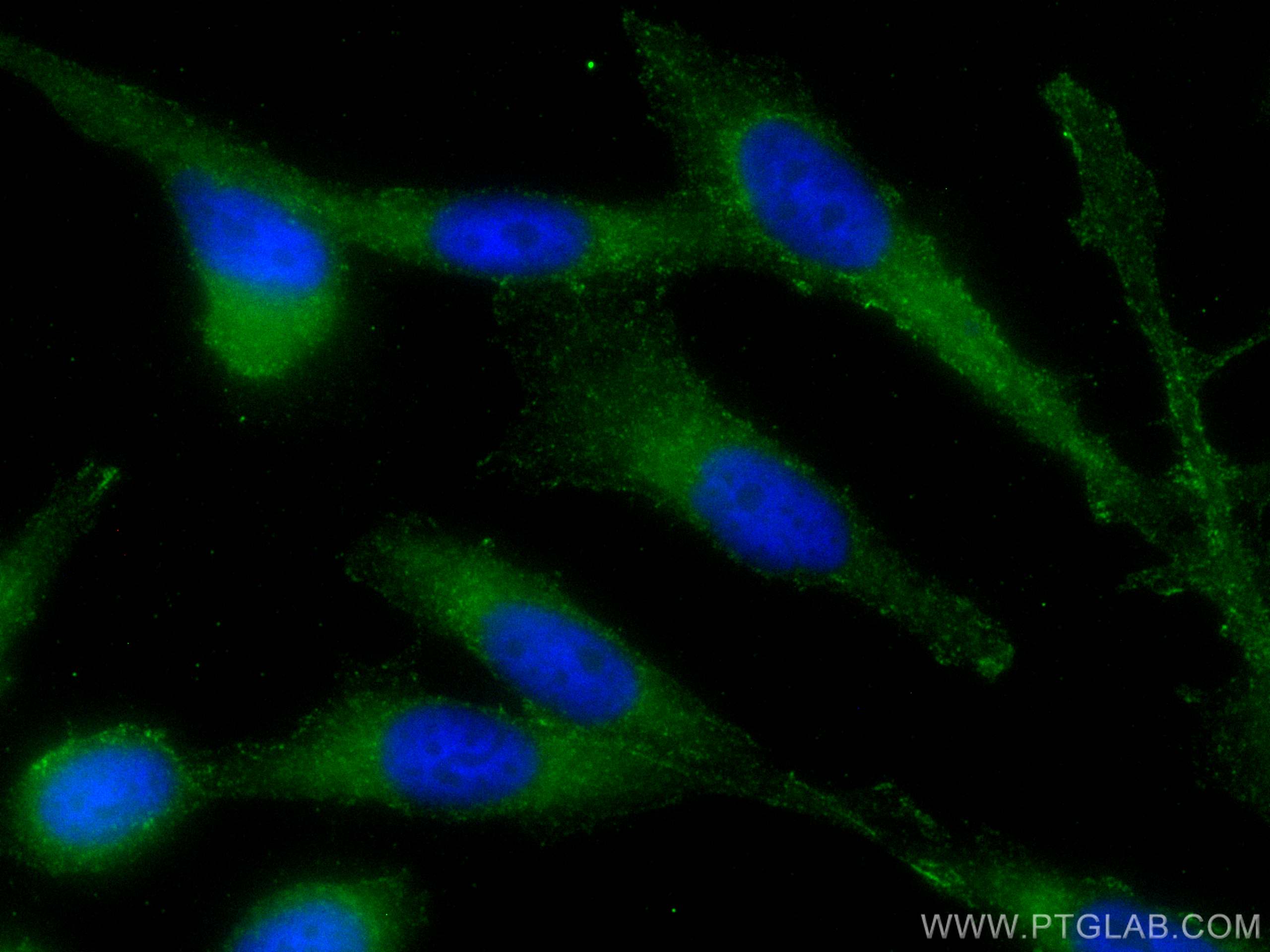 Immunofluorescence (IF) / fluorescent staining of PC-3 cells using TFF2 Polyclonal antibody (13681-1-AP)