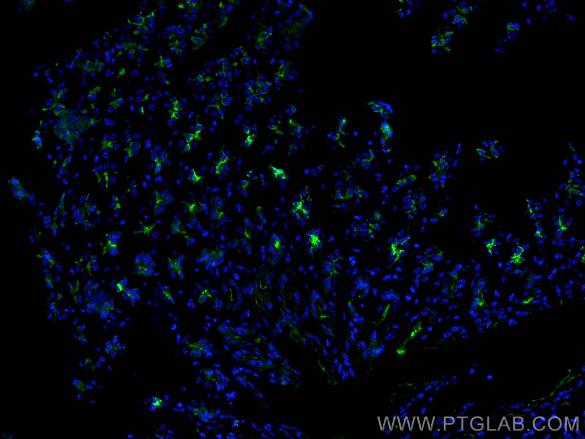 IF Staining of mouse stomach using 13681-1-AP