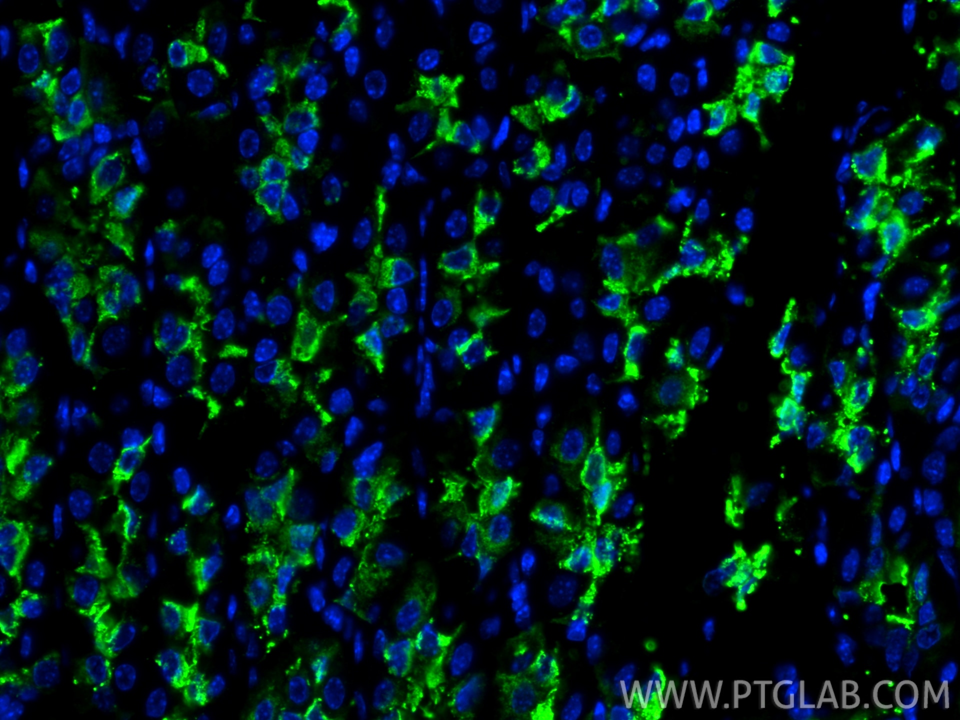IF Staining of mouse stomach using 13681-1-AP (same clone as 13681-1-PBS) Immunofluorescence (IF) / fluorescent staining of mouse stomach tissue using TFF2 Polyclonal antibody (13681-1-AP)