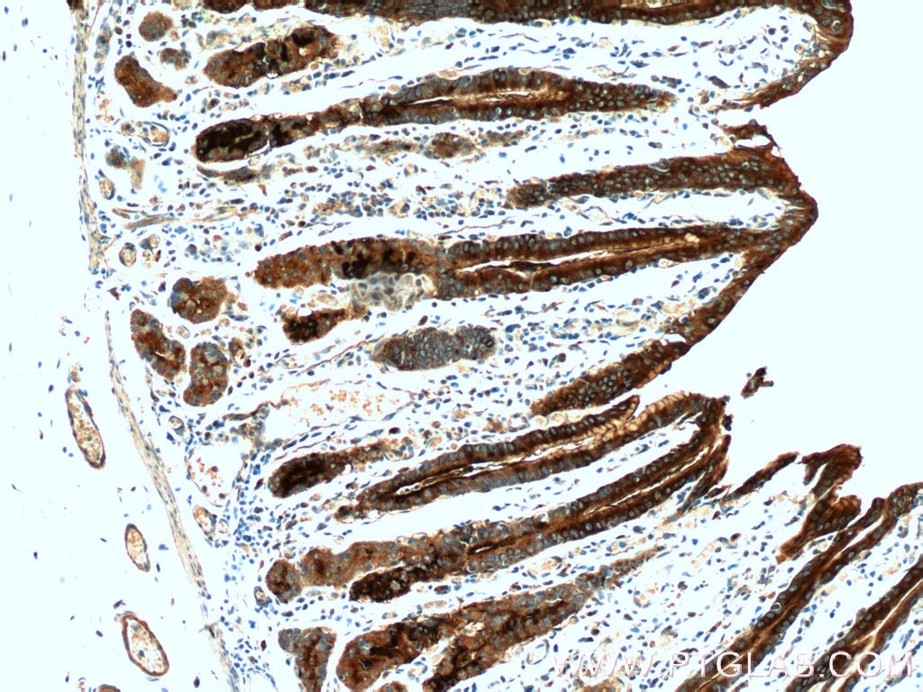 Immunohistochemistry (IHC) staining of human stomach tissue using TFF2 Polyclonal antibody (13681-1-AP)