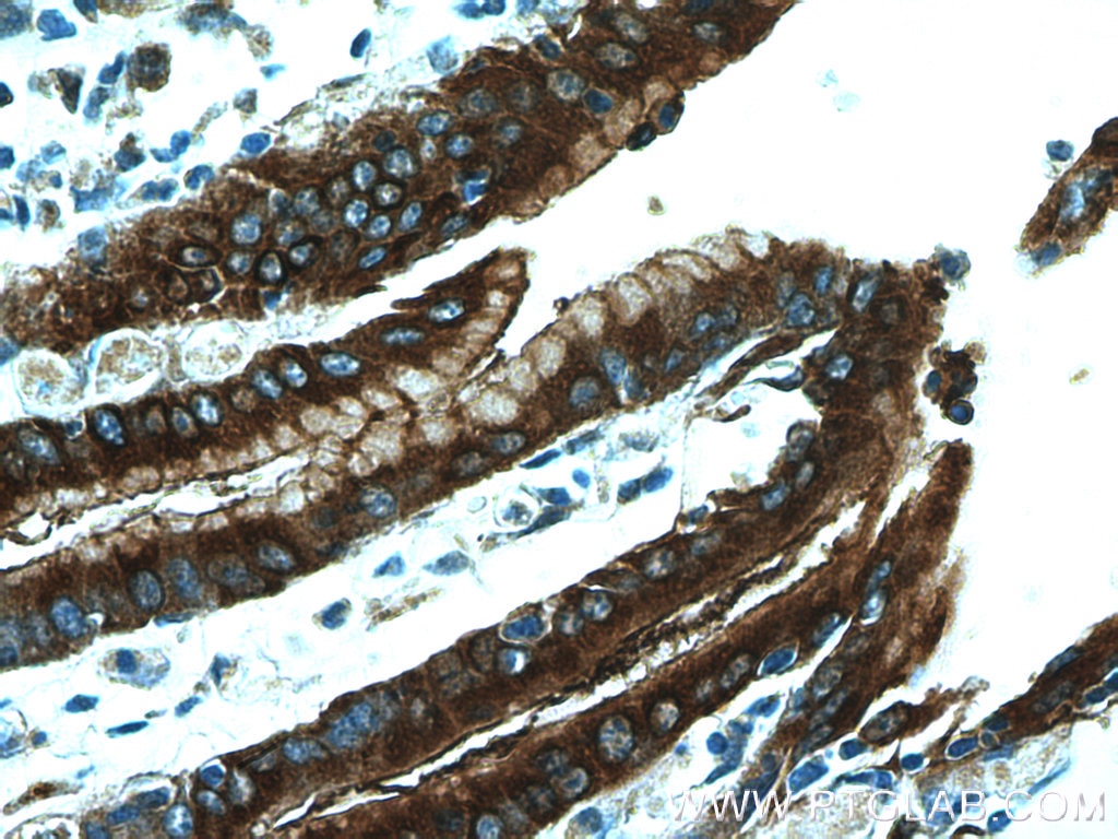 Immunohistochemistry (IHC) staining of human stomach tissue using TFF2 Polyclonal antibody (13681-1-AP)