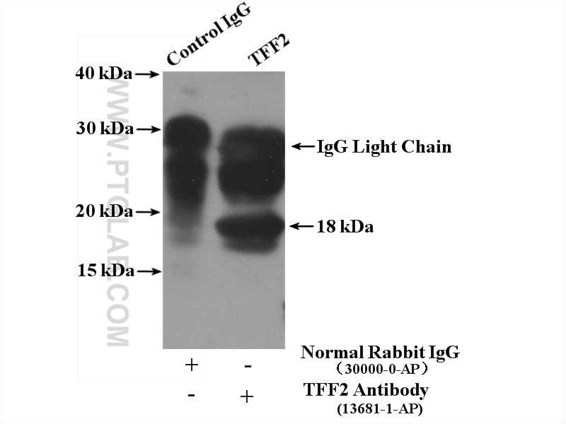 Immunoprecipitation (IP) experiment of mouse stomach tissue using TFF2 Polyclonal antibody (13681-1-AP)