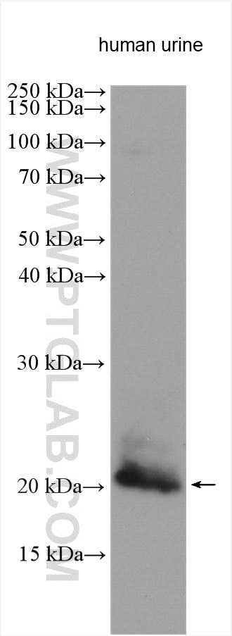 Western Blot (WB) analysis of various lysates using TFF2 Polyclonal antibody (13681-1-AP)