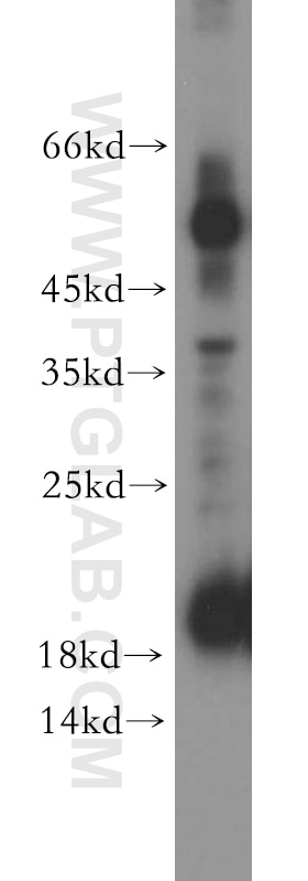 Western Blot (WB) analysis of human stomach tissue using TFF2 Polyclonal antibody (13681-1-AP)