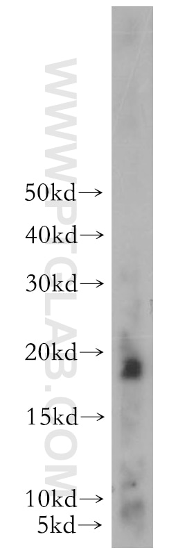 Western Blot (WB) analysis of human stomach tissue using TFF2 Polyclonal antibody (13681-1-AP)