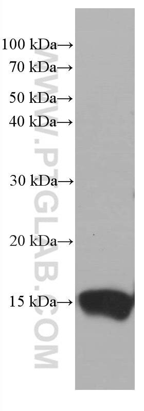 Western Blot (WB) analysis of pig pancreas tissue using TFF2 Monoclonal antibody (66471-1-Ig)