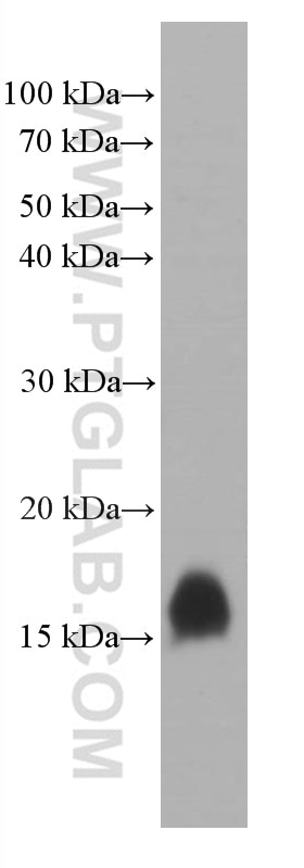 Western Blot (WB) analysis of rat pancreas tissue using TFF2 Monoclonal antibody (66471-1-Ig)