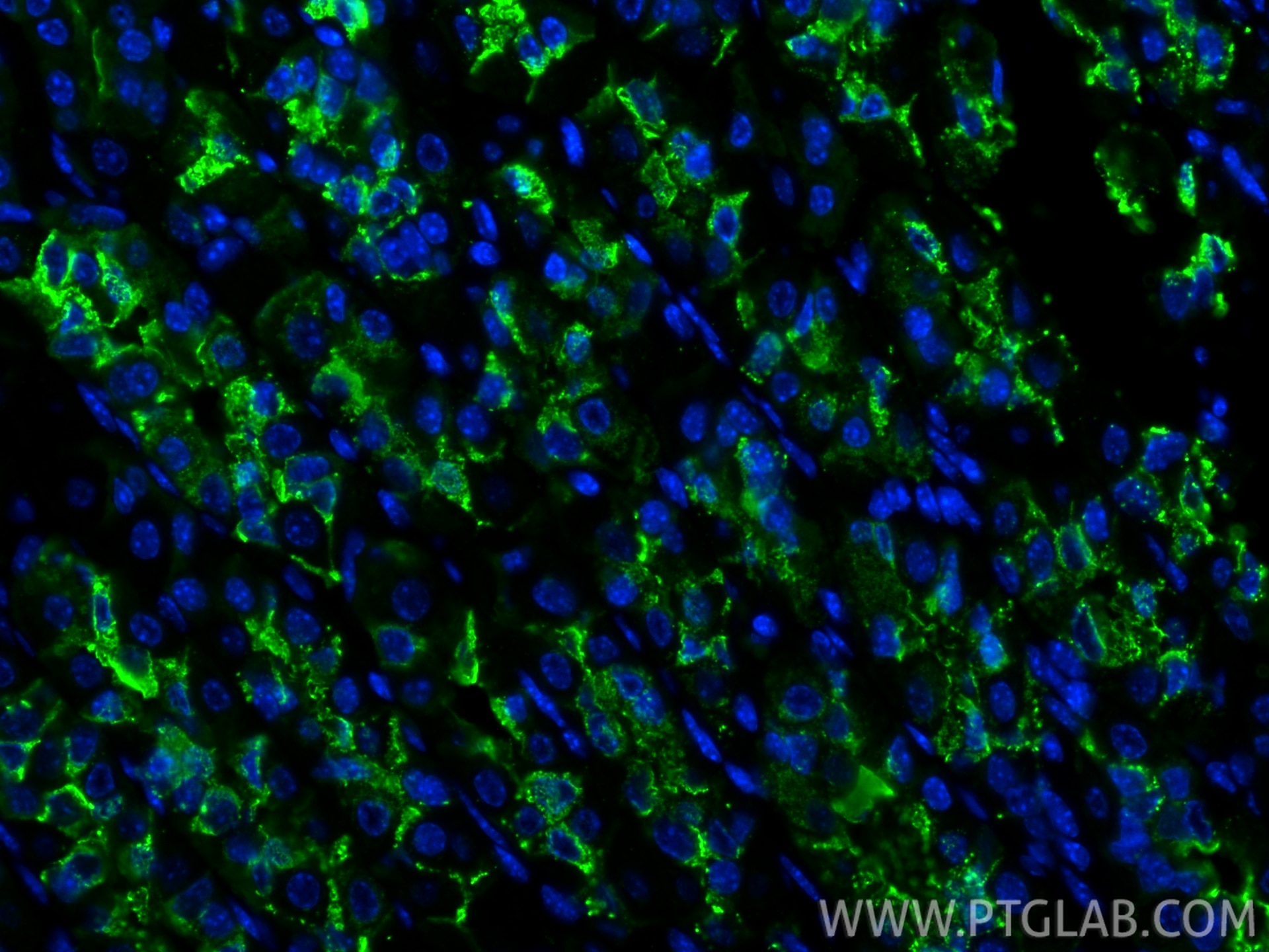 Immunofluorescence (IF) / fluorescent staining of mouse stomach tissue using CoraLite® Plus 488-conjugated TFF2 Polyclonal anti (CL488-13681)