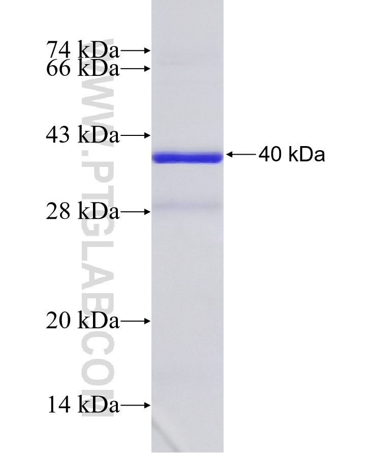 TFF2 fusion protein Ag4537 SDS-PAGE