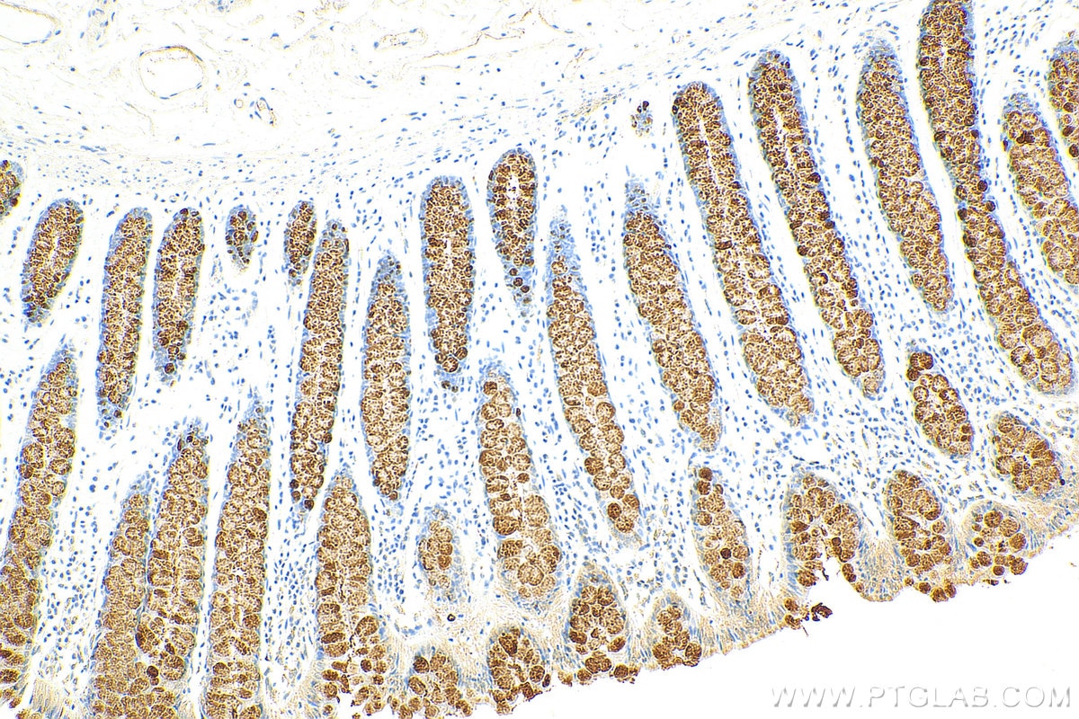 Immunohistochemistry (IHC) staining of human colon tissue using Trefoil factor 3 Polyclonal antibody (23277-1-AP)