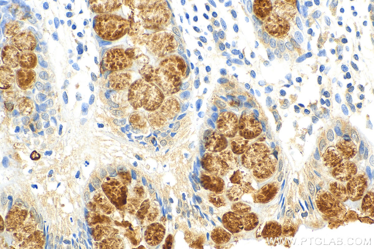 Immunohistochemistry (IHC) staining of human colon tissue using Trefoil factor 3 Polyclonal antibody (23277-1-AP)