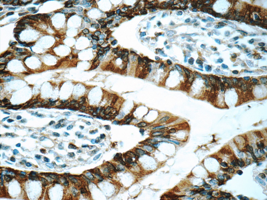 Immunohistochemistry (IHC) staining of human small intestine tissue using Trefoil factor 3 Polyclonal antibody (23277-1-AP)