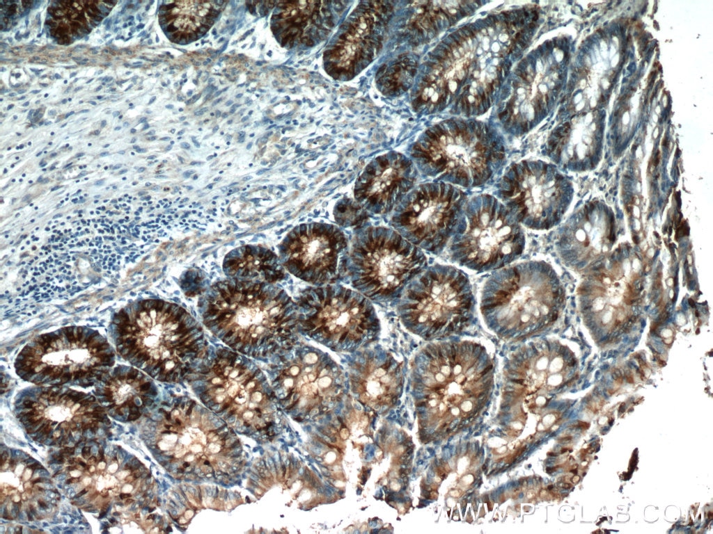 Immunohistochemistry (IHC) staining of human colon tissue using Trefoil factor 3 Polyclonal antibody (23277-1-AP)