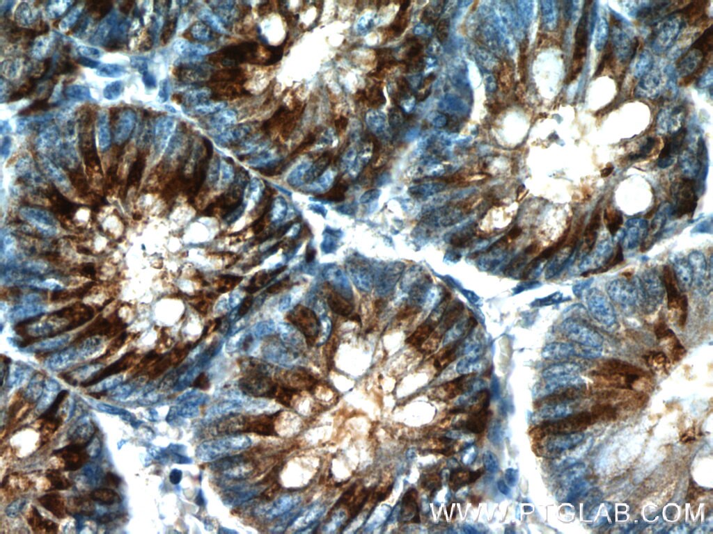 Immunohistochemistry (IHC) staining of human colon tissue using Trefoil factor 3 Polyclonal antibody (23277-1-AP)