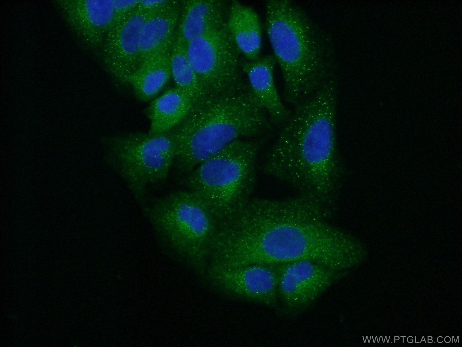 Immunofluorescence (IF) / fluorescent staining of A549 cells using TFG Polyclonal antibody (11571-1-AP)
