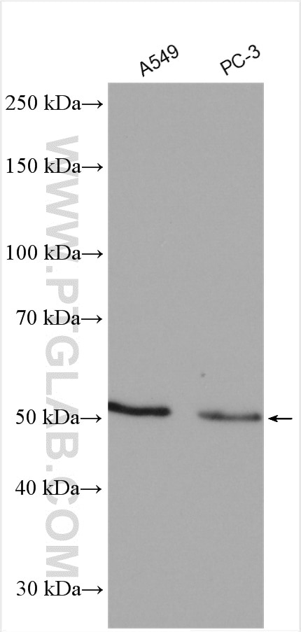 Western Blot (WB) analysis of various lysates using TFG Polyclonal antibody (11571-1-AP)